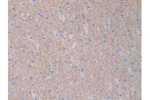 DAB staining on IHC-P; Samples: Human Brain Tissue. (GHRH anticorps  (AA 19-108))