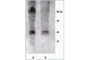Image no. 1 for anti-Phosphothreonine antibody (ABIN264877) (Phosphothreonine anticorps)