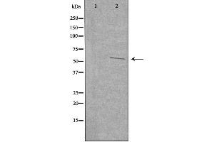 Western blot analysis of extracts from COLO cells, using UGDH antibody. (UGDH anticorps  (C-Term))