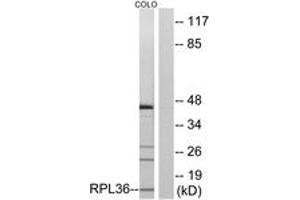Western blot analysis of extracts from COLO cells, using RPL36 Antibody. (RPL36 anticorps  (AA 51-100))