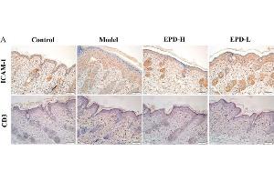 EPD inhibited inflammatory cell infiltration in IMQ-induced psoriasis-like mouse mode. (ICAM1 anticorps  (AA 201-300))
