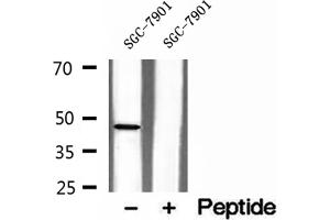 Western blot analysis of extracts of SGC-7901 cells, using NOB1 antibody. (NOB1 anticorps  (C-Term))