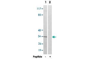 Western blot analysis of extracts from Jurkat cells, using AQP12A polyclonal antibody . (Aquaporin 12A anticorps)