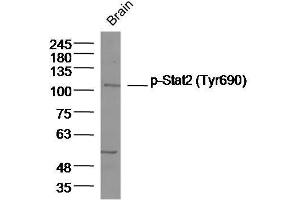 Mouse brain lysates probed with Stat2 (Tyr690) Polyclonal Antibody, unconjugated  at 1:300 overnight at 4°C followed by a conjugated secondary antibody for 60 minutes at 37°C.