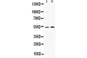 Western blot analysis of SERPINA1 expression in rat brain extract ( Lane 1) and HELA whole cell lysates ( Lane 2). (SERPINA1 anticorps  (AA 25-204))
