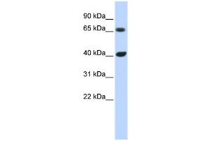 WB Suggested Anti-CCND1 Antibody Titration:  0.