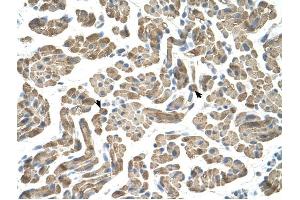 NEU1 antibody was used for immunohistochemistry at a concentration of 4-8 ug/ml to stain Skeletal muscle cells (arrows) in Human Muscle.