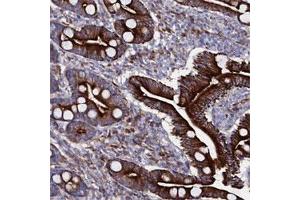 Immunohistochemical staining of human duodenum shows strong cytoplasmic and membranous positivity in glandular cells.