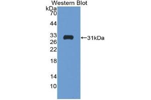 Detection of Recombinant Follistatin, Human using Polyclonal Antibody to Follistatin (FS)