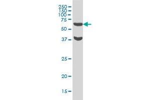 RPS6KB1 monoclonal antibody (M02), clone 1E10 Western Blot analysis of RPS6KB1 expression in HeLa .