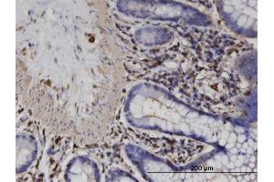 Immunoperoxidase of monoclonal antibody to ACTRT2 on formalin-fixed paraffin-embedded human colon.