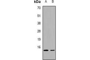 Western blot analysis of FABP2 expression in K562 (A), mouse lung (B) whole cell lysates.