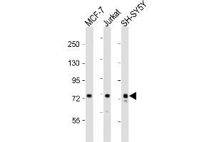 All lanes : Anti-KIF22 Antibody (Center) at 1:2000 dilution Lane 1: MCF-7 whole cell lysates Lane 2: Jurkat whole cell lysates Lane 3: SH-SY5Y whole cell lysates Lysates/proteins at 20 μg per lane. (KIF22 anticorps  (AA 423-456))