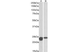 ABIN768566 (0. (SOD2 anticorps  (AA 119-130))