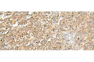 Immunohistochemistry of paraffin-embedded Human tonsil tissue using FLOT2 Polyclonal Antibody at dilution of 1:50(x200)