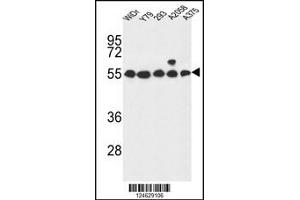 Western blot analysis in WiDr,Y79,293,A2058,A375 cell line lysates (35ug/lane). (GPR180 anticorps  (AA 119-147))
