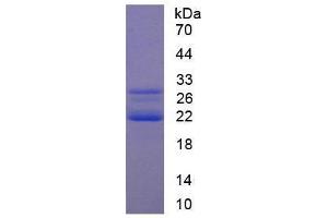Image no. 1 for Cold Inducible RNA Binding Protein (CIRBP) (AA 1-172) (Active) protein (His tag) (ABIN5665778) (CIRBP Protein (AA 1-172) (His tag))