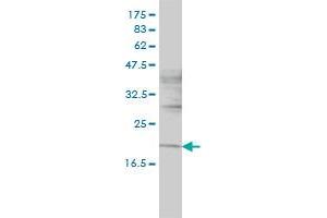 NIFUN monoclonal antibody (M01), clone 3B8-1C4 Western Blot analysis of NIFUN expression in HL-60 .