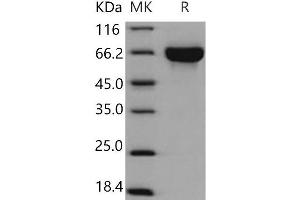 Western Blotting (WB) image for Kin of IRRE Like 3 (KIRREL3) (Active) protein (His tag) (ABIN7320308)