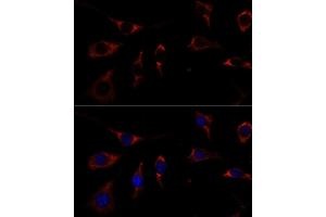 Immunofluorescence analysis of L929 cells using RPL26 antibody (ABIN7269999) at dilution of 1:100.