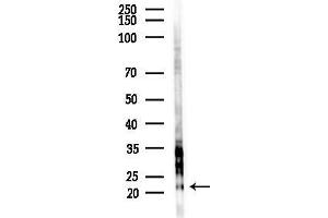 Western blot analysis of lysates from HUVEC cells(starvation,24h treatment), using TFIP8 Antibody at 1/1000 dilution.