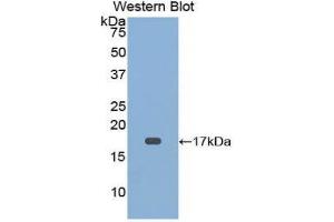 Western Blotting (WB) image for anti-CD59 (CD59) (AA 22-96) antibody (ABIN3206840) (CD59 anticorps  (AA 22-96))