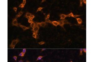 Immunofluorescence analysis of NIH/3T3 cells using PDGFR beta Polyclonal Antibody at dilution of 1:100. (PDGFRB anticorps)