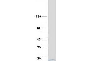 Glutathione Transferase zeta 1 (Maleylacetoacetate Isomerase) (GSTZ1) (Transcript Variant 3) protein (Myc-DYKDDDDK Tag)