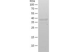 Western Blotting (WB) image for Diacylglycerol O-Acyltransferase 1 (DGAT1) (AA 1-90) protein (His-IF2DI Tag) (ABIN7122653) (DGAT1 Protein (AA 1-90) (His-IF2DI Tag))