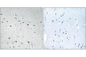Immunohistochemistry analysis of paraffin-embedded human brain tissue, using CDC25C (Ab-48) Antibody. (CDC25C anticorps  (AA 14-63))