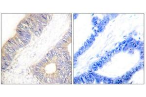 Immunohistochemistry (IHC) image for anti-Cystatin A (Stefin A) (CSTA) (Internal Region) antibody (ABIN1848778) (CSTA anticorps  (Internal Region))