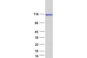 Validation with Western Blot