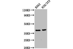 Western Blot Positive WB detected in: K562 whole cell lysate, NIH/3T3 whole cell lysate All lanes: ZNF367 antibody at 6 μg/mL Secondary Goat polyclonal to rabbit IgG at 1/50000 dilution Predicted band size: 39, 33 kDa Observed band size: 39 kDa (ZNF367 anticorps  (AA 83-151))