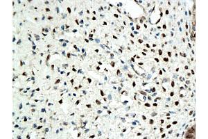 Formalin-fixed and paraffin embedded rat ovary tissue labeled with Anti-ER beta Polyclonal Antibody, Unconjugated (ABIN725210), followed by conjugation to the secondary antibody and DAB staining (ESR2 anticorps  (AA 201-300))