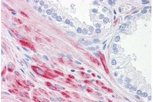 Human Prostate: Formalin-Fixed, Paraffin-Embedded (FFPE)