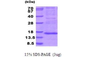 SDS-PAGE (SDS) image for Mitochondrial Ribosomal Protein S28 (MRPS28) (AA 72-187) protein (His tag) (ABIN5854040)