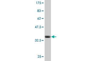 Western Blot detection against Immunogen (37.