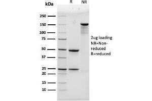 SDS-PAGE Analysis Purified ACTN4 Mouse Monoclonal Antibody (93). (alpha Actinin 4 anticorps)