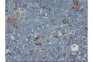 Image no. 3 for anti-Carboxypeptidase A2 (Pancreatic) (CPA2) antibody (ABIN1497596)