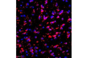 Immunofluorescence of paraffin embedded mouse brain using eIF5A2 (ABIN7073893) at dilution of 1:300 (400x lens)