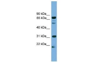 SLC6A3 antibody used at 0.