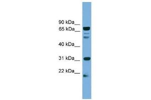 SLC6A3 antibody used at 0. (SLC6A3 anticorps  (N-Term))