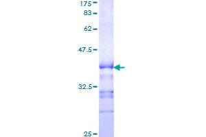 Image no. 1 for Kinase Suppressor of Ras 1 (KSR1) (AA 301-400) protein (GST tag) (ABIN1309081)