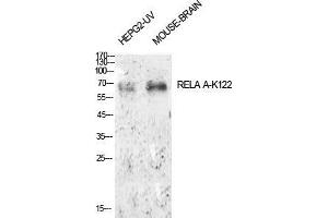 Western Blot (WB) analysis of HepG2-UV, Mouse Brain cells using Acetyl-NFkappaB-p65 (K122) Polyclonal Antibody.