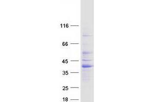 Validation with Western Blot