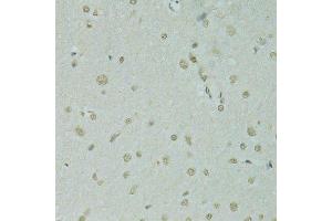 Immunohistochemistry of paraffin-embedded rat brain using SAFB antibody.