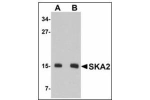 Western blot analysis of SKA2 in 3T3 cell lysate with SKA2 antibody at (A) 0. (FAM33A anticorps  (N-Term))