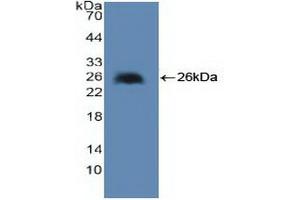 Detection of Recombinant cPLA2, Human using Polyclonal Antibody to Cytosolic Phospholipase A2 (PLA2G4)