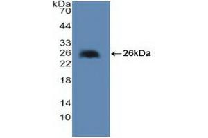 Detection of Recombinant cPLA2, Human using Polyclonal Antibody to Cytosolic Phospholipase A2 (PLA2G4) (PLA2G4A anticorps  (AA 1-178))