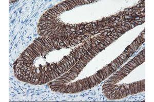 Image no. 2 for anti-Signal Recognition Particle Receptor, B Subunit (SRPRB) antibody (ABIN1501126)